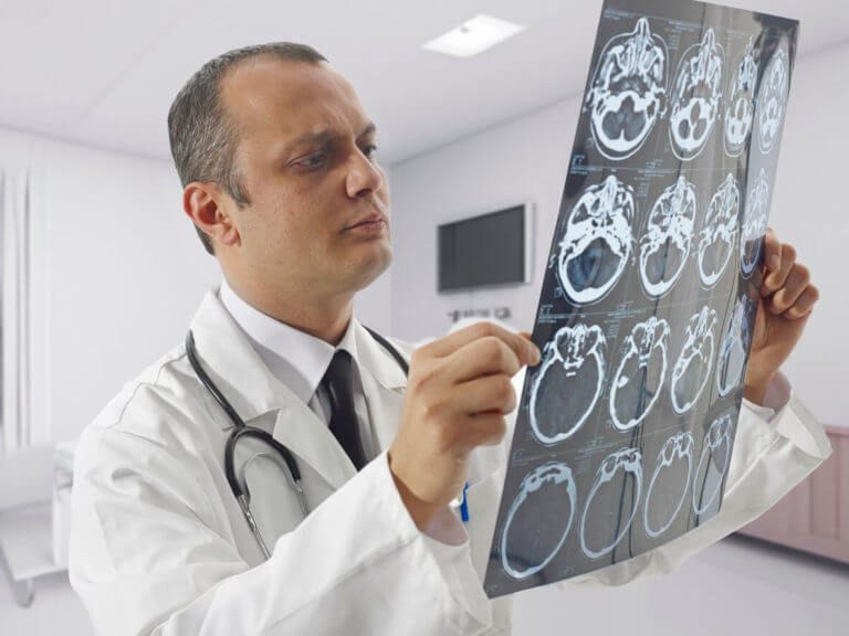 neurologist looking at MRI