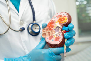 Image of a doctor holding a human kidney model and pointing to it while explaining chronic kidney disease (CKD) to a patient with kidney disease.