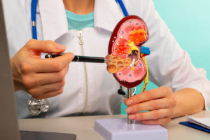 A urologist is showing a pen on a plastic model of a human kidney in close-up while explaining kidney stone treatment.