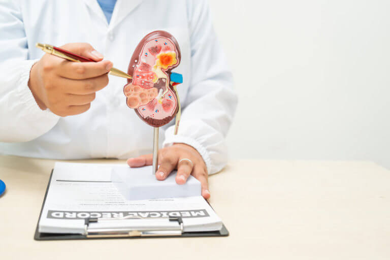 A female urologist is discussing kidney stones.